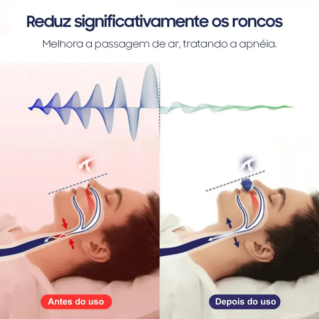 Dilatador eletrônico night fluo - Tratamento contra ronco e apneia de fluxo contínuo de ar | Purevital