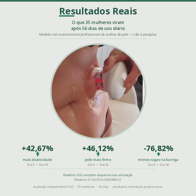 Sculpiflex — Reafirme a pele flácida, elimine a gordura localizada e suavize a celulite